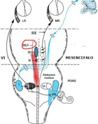 fascículo longitudinal superior